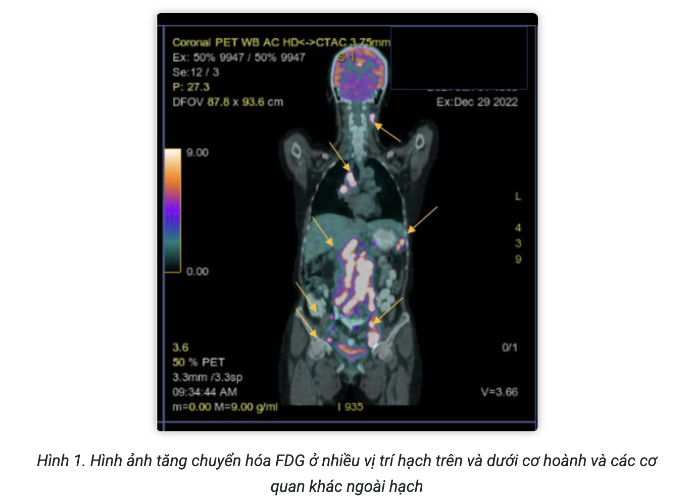 Screenshot 2026-02-25 at 15.11.24.png