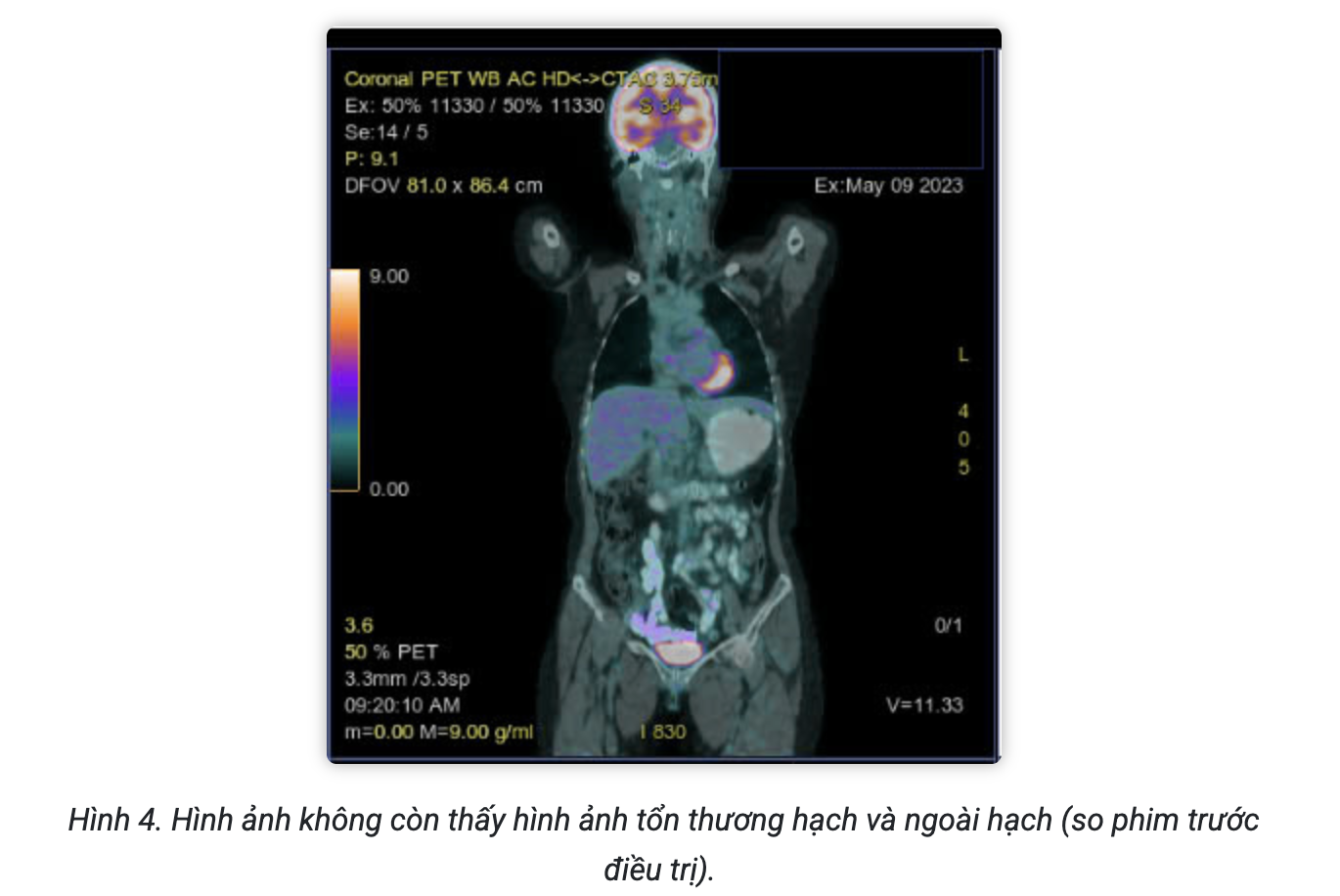 Screenshot 2026-02-25 at 15.12.08.png