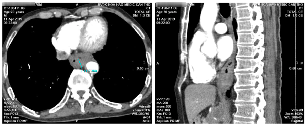 K thực quan - 3.png